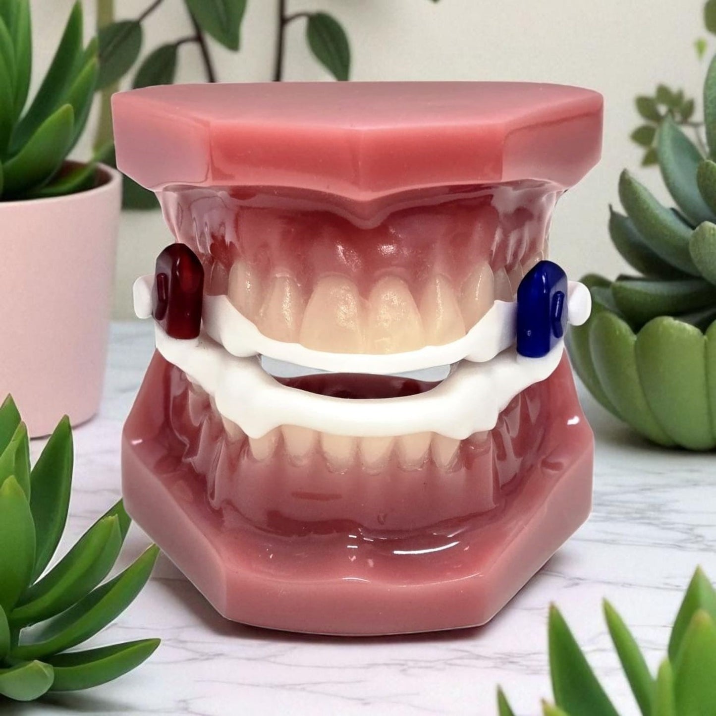 Our Design Aer Dorsal MAS (Dental lab only price)