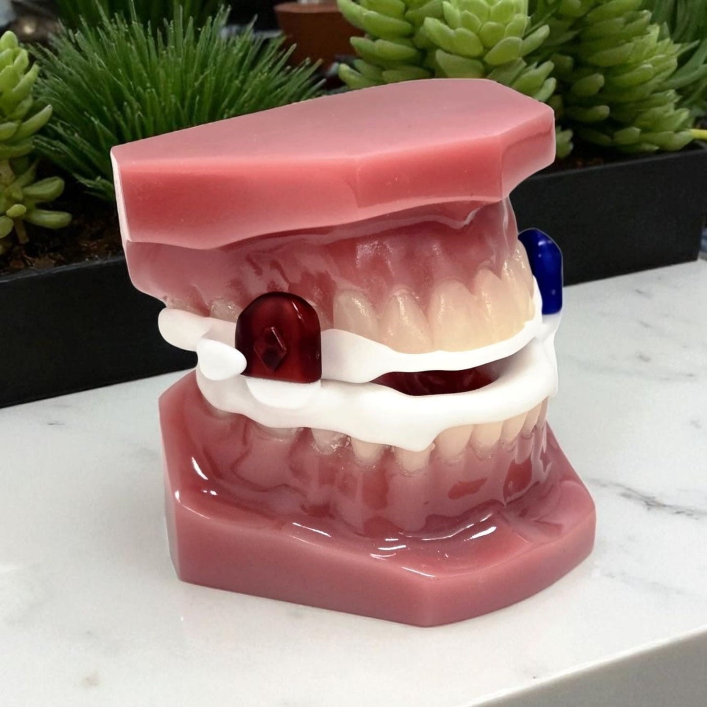 Typodont with Aer Dorsal MAS